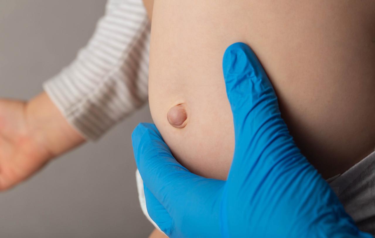 Kūdikio pilvas ir bamba su bambos išvarža