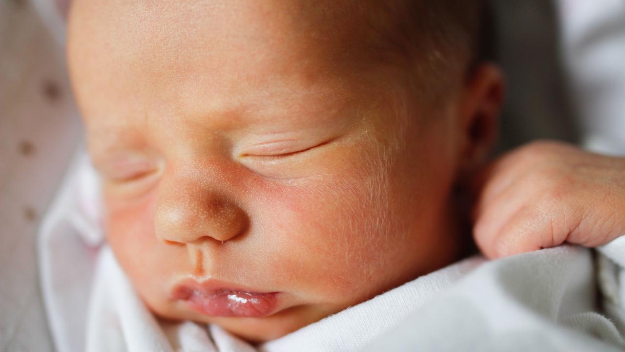 Balti spuogeliai ant naujagimio odos (miliumai)