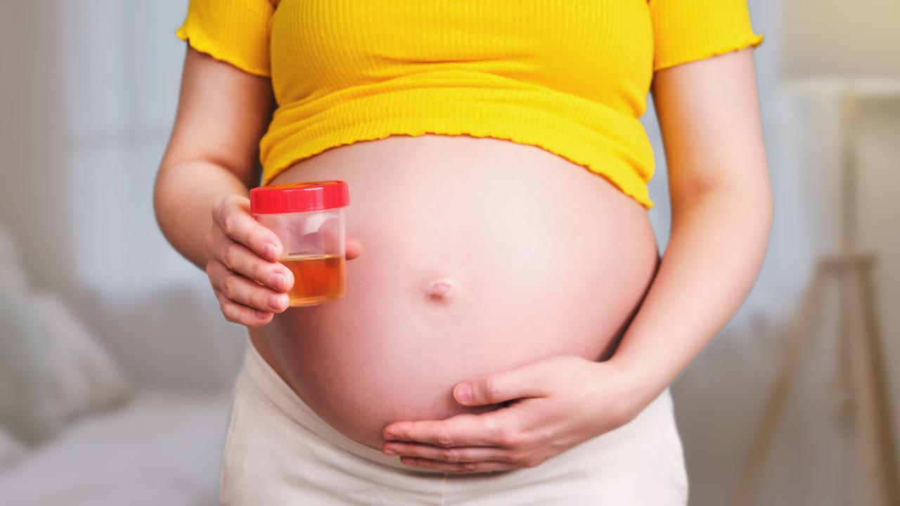 Padidėjęs baltymo kiekis šlapime nėštumo metu